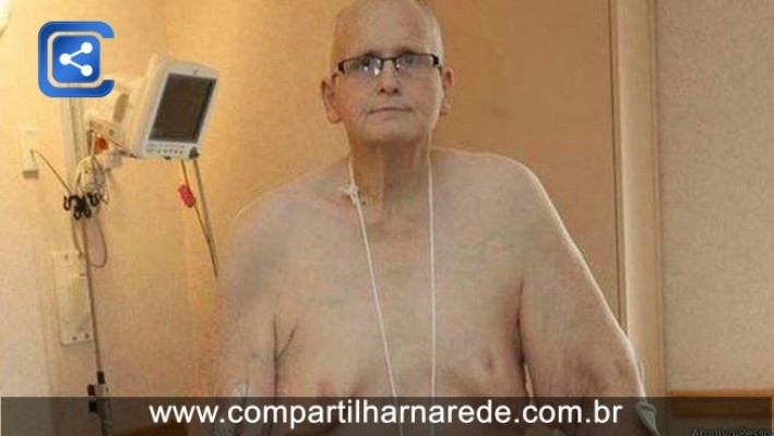 Ex-'mais gordo do mundo' remove 25 kg de pele e diz que ficou com 'perna de papel'