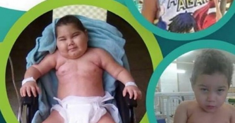 Bazar arrecadará recursos para criança salgueirense diagnosticada com tumor na coluna