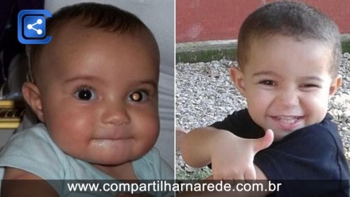 Caso de bebê que teve câncer no olho descoberto em foto alerta outros pais.