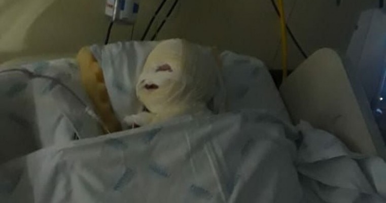 Bebê ferido após explosão de aparelho em hospital de BH passa por terceira cirurgia