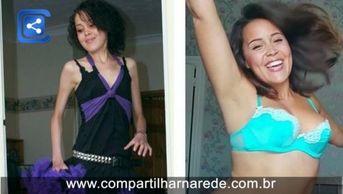 Ex-anoréxica cria campanha no Instagram para celebrar curvas femininas