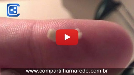 Veja nesse video o que são aquelas bolinhas amarelas fedidas que saem da boca