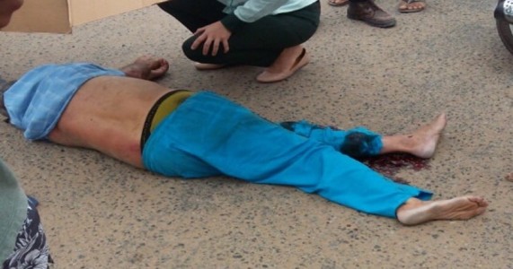 Petrolina PE – Homem foi Atropelado na Entrada do Jatobá