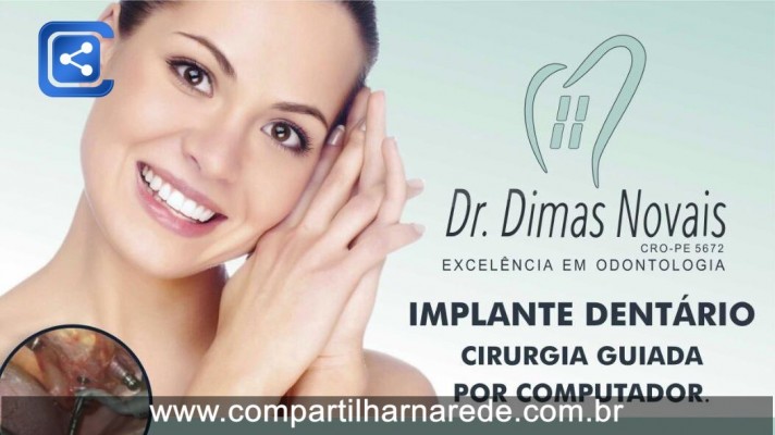 Implante Dentário, Cirurgia Guiada por Computador em Salgueiro, PE - Dr. Dimas Novais