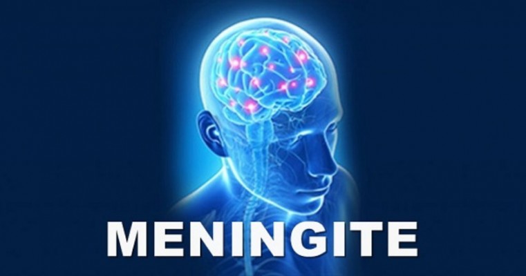 Meningite