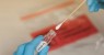 Funcionários de laboratório em Pernambuco são presos por falsificar resultados de exame de covid