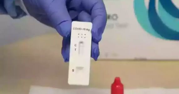 Testes positivos de Covid saltam de 3% para 17% no Brasil