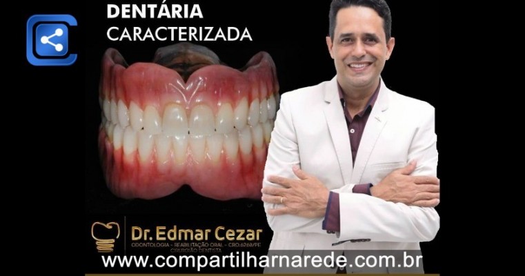 Prótese Dentária fixa em Salgueiro, PE Dr Edmar Cezar