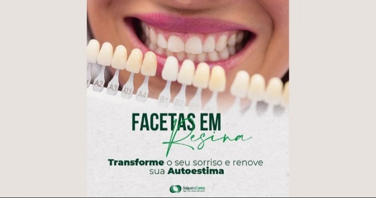 Facetas em resina em Salgueiro Center - Dr Leandro