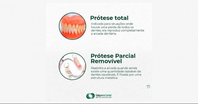 Protese total em Salgueiro Center - Dr Leandro