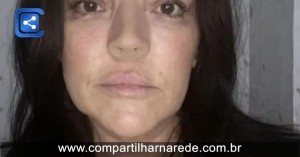 Mulher de 49 anos precisa retirar todo o nariz após meses sentindo cheiros estranhos