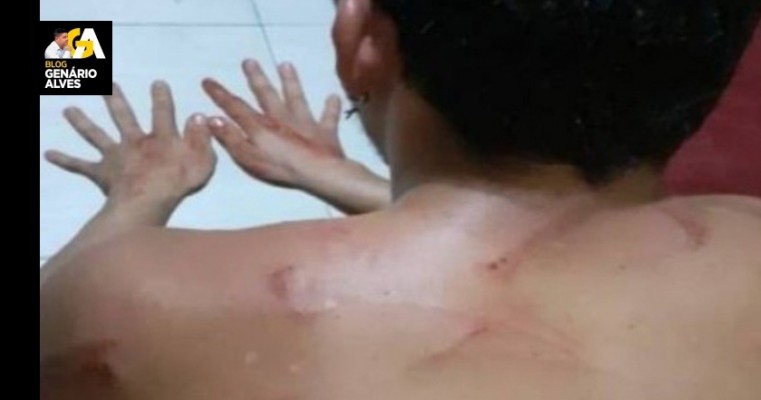 Jovem é agredido com tapas, chutes e arranhões pela ex-namorada menor após ela visualizar status 