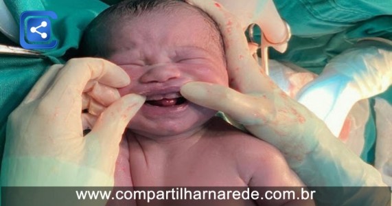 Bebê nasce com dentes e surpreende obstetra e mãe em Campo Grande