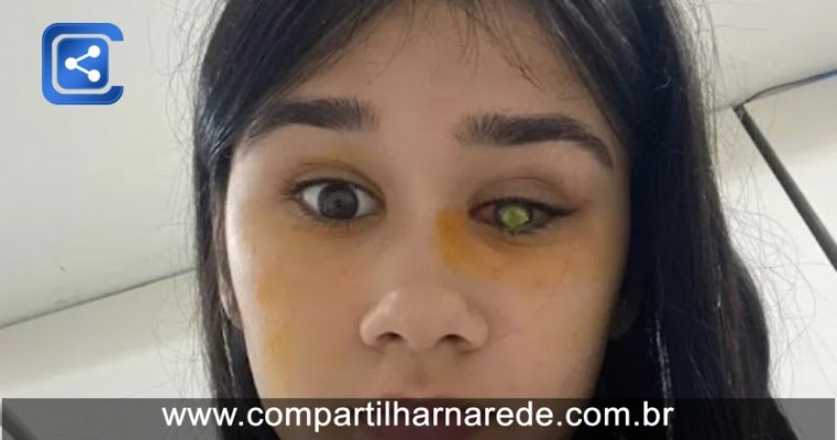 Estudante perde visão após mau uso de lentes de contato e vai parar na fila do transplante