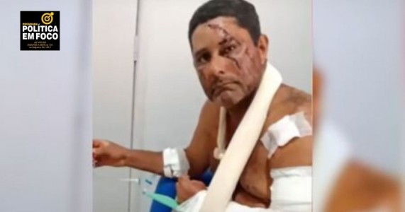 VAQUEIRO É ATACADO POR ONÇA-PINTADA  E SE DEFENDE COM FACÃO CONSEGUINDO SOBREVIVER