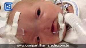 Bebê que nasceu sem nariz vai para casa após três semanas de internação