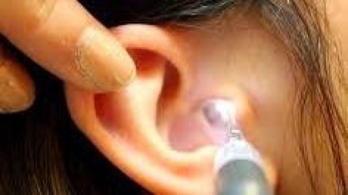 A origem da cera do ouvido.